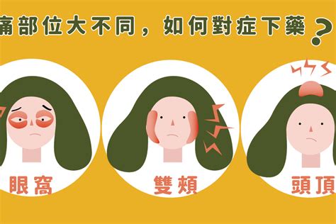 容易頭痛|頭痛怎麼辦？何時該就醫？秒懂頭痛原因、位置及症狀｜元氣